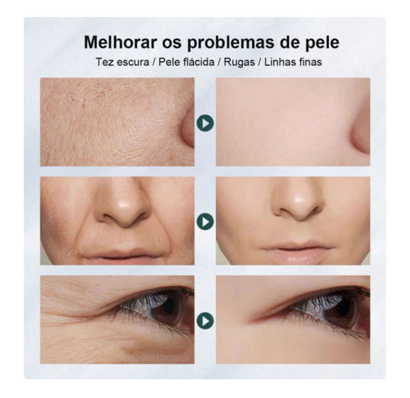 Face Lift - Massageador  7em1 Lifting Facial